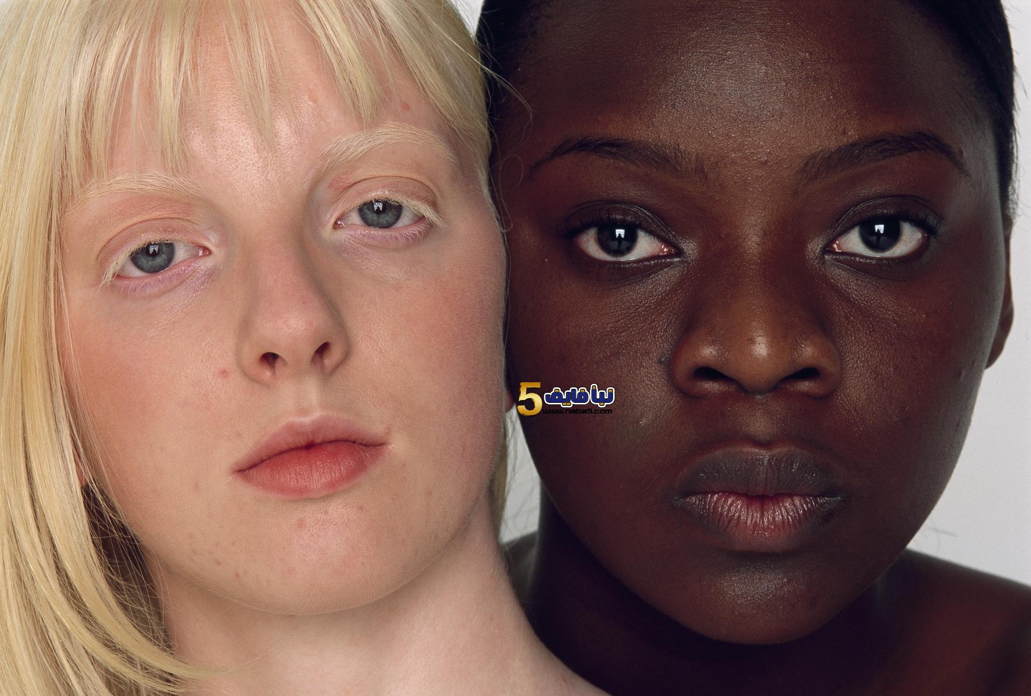 الحفاظ على اللون الطبيعي للمناطق الحساسة