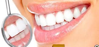تبييض الأسنان..وصفات طبيعية من المنزل لأسنان بيضاء وبراقة