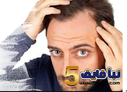 تفسير حلم الصلع في مقدمة الرأس