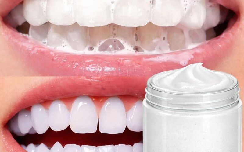 تببيض الاسنان بياض الثلج بوصفه سهله جداً